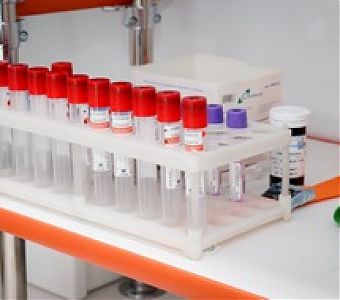 О профилактике туберкулеза и рака легких